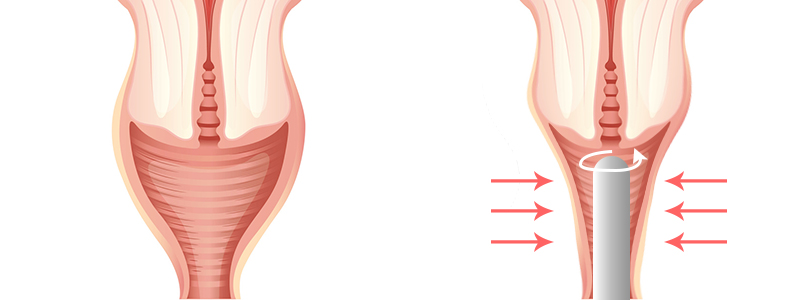 ��������Ÿ��Ʈ��